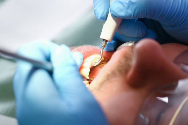 Best Emergency TMJ Treatment in Somerville, TX