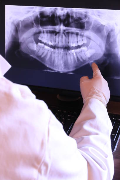 Best Emergency Dental Care for Broken or Chipped Teeth in Somerville, TX